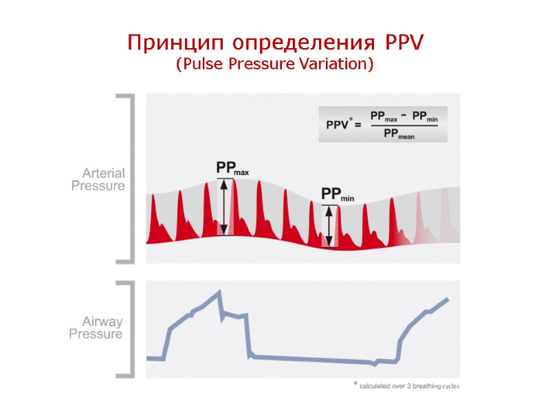 Принцип определения PPV (Pulse Pressure Variation)